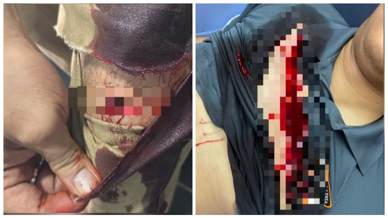 Warga emas cederakan pegawai, anggota polis guna pisau pemotong kertas berjaya ditahan 1 cedera kulim